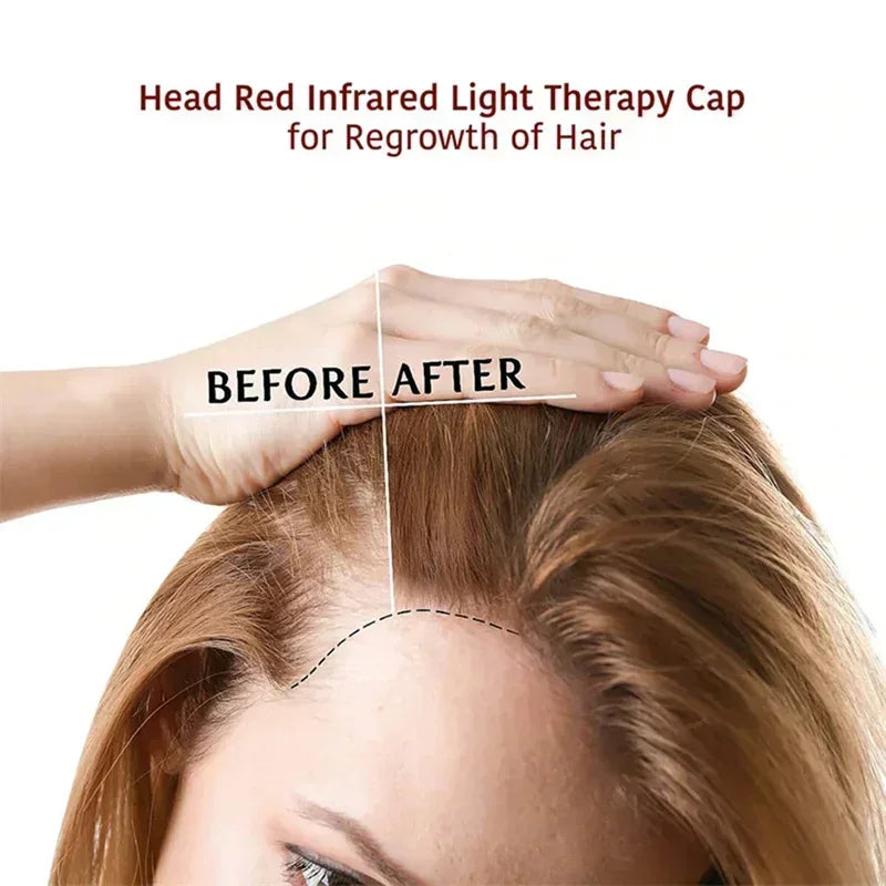 LED Red Light Therapy Cap Hair Growth & Hair Loss Treatment